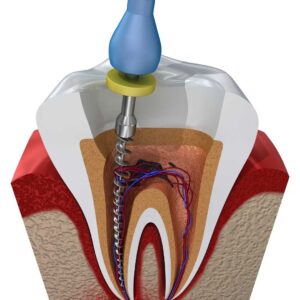 Endodonzia e conservativa
