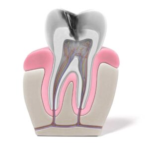 Endodonzia e conservativa